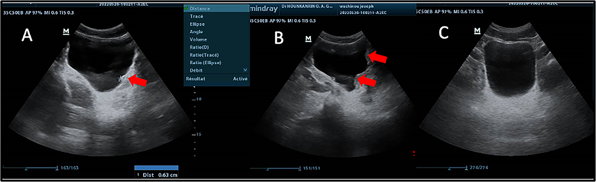 Figure 4 Refer to the following caption and surrounding text.